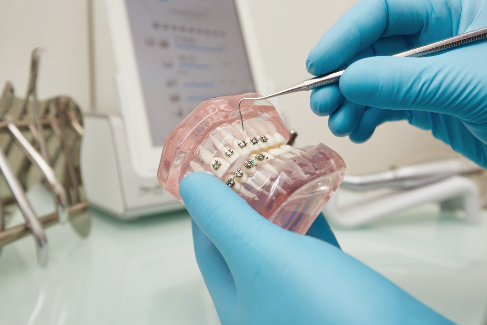 Braces Treatment