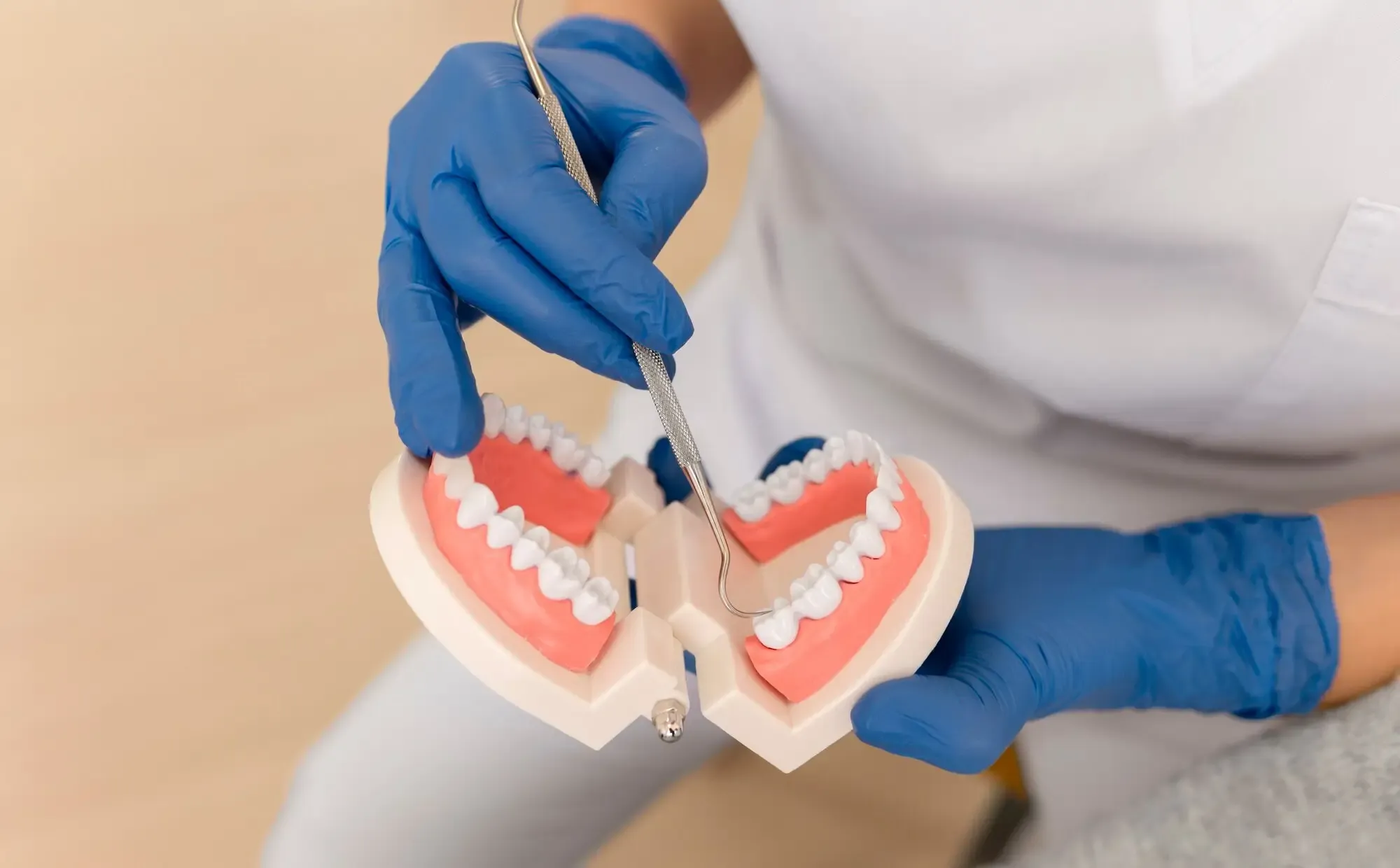 Complete Dentures