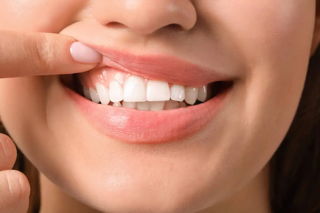 Symptoms of Gum Diseases and Treatment Methods