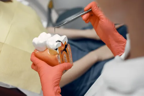 Root Canal Treatment (Endodontics)